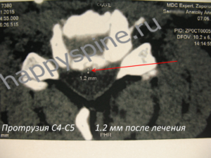 2 С4 С5 после 1